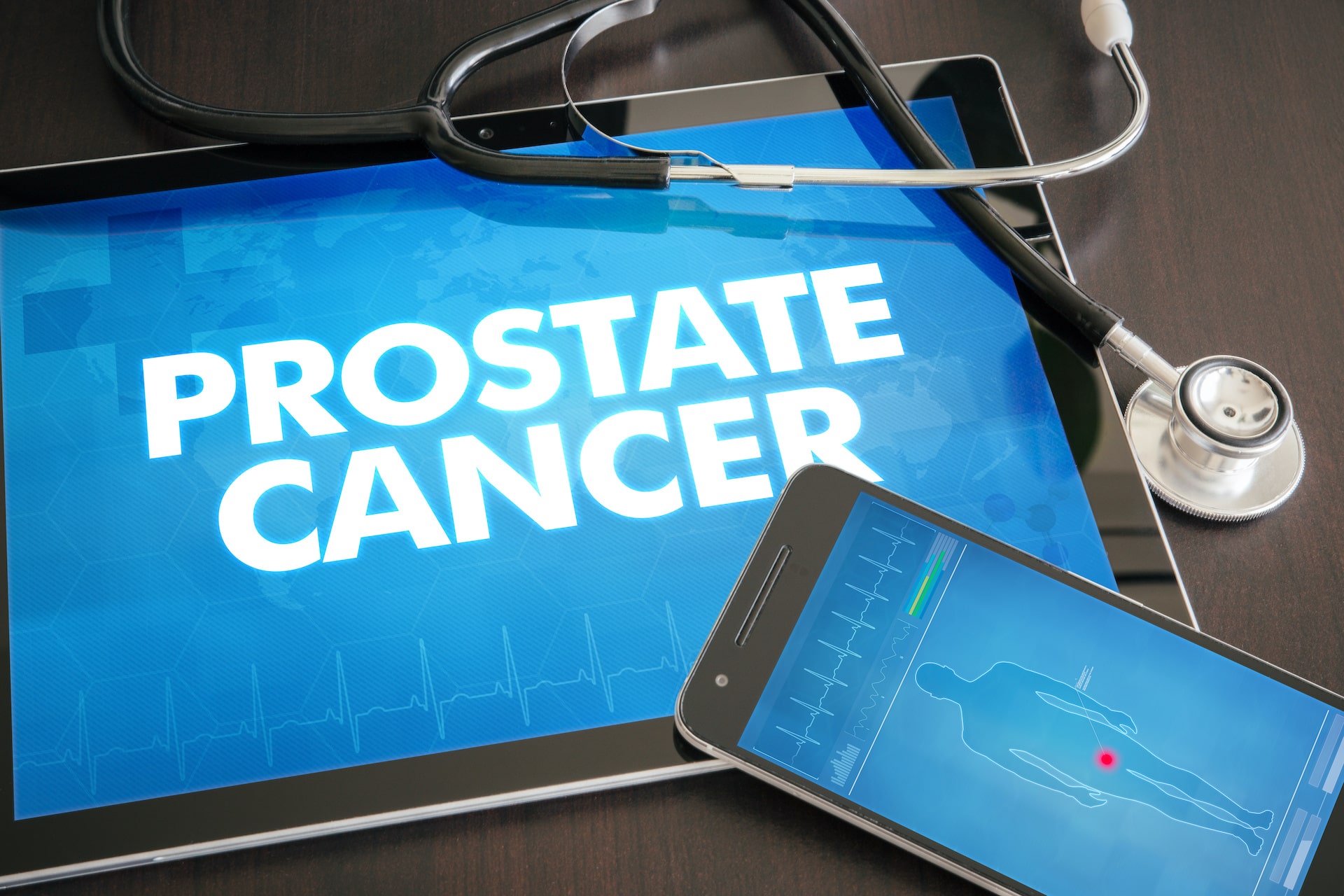 Radiation treatment for prostate cancer in Kansas City