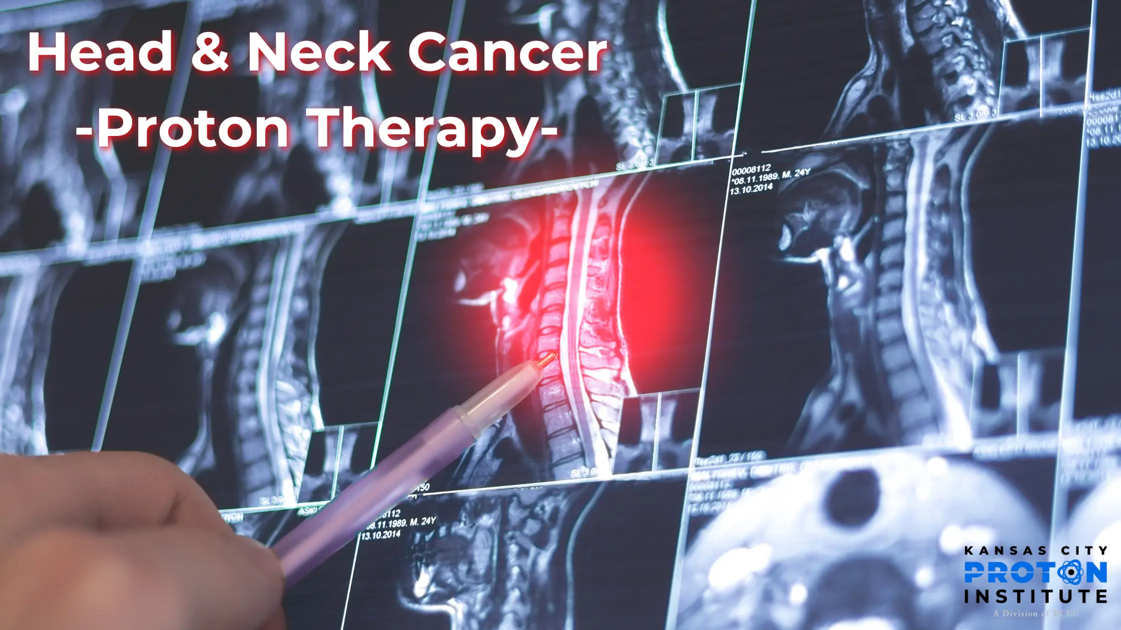 Head and Neck Cancer, KC, March 2026, KCPI